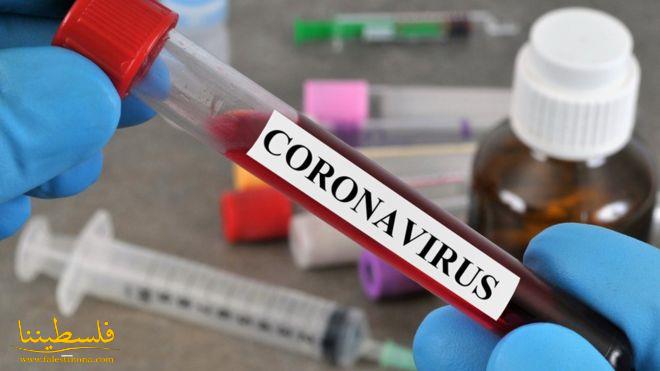 تسجيل 106 إصابات جديدة بفيروس كورونا ترفع إصابات اليوم إلى 404