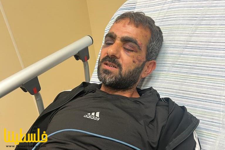 المعتقل زهران يروي تفاصيل مروّعة عن اعتداء جنود الاحتلال عليه